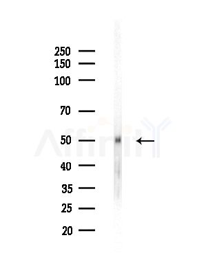 NIM1 Antibody - Western blot analysis of lysates from Hela cells(heat-shock,45min treatment), using NIM1 Antibody at 1/1000 dilution.