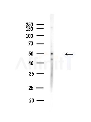 NIM1 Antibody - Western blot analysis of lysates from B16F10-LUC cells(starvation,24h treatment), using NIM1 Antibody at 1/1000 dilution.