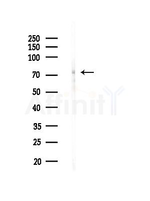 PLK3 Antibody - Western blot analysis of lysates from A375 cells(LPS, 4h treatment), using PLK3 Antibody at 1/1000 dilution.