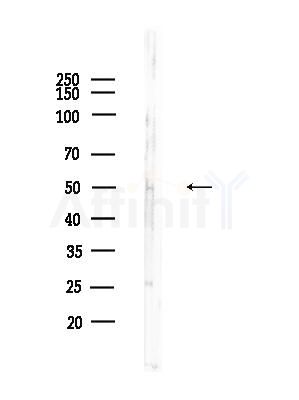PLK5 Antibody - Western blot analysis of lysates from Mouse brain, using PLK5 Antibody at 1/1000 dilution.