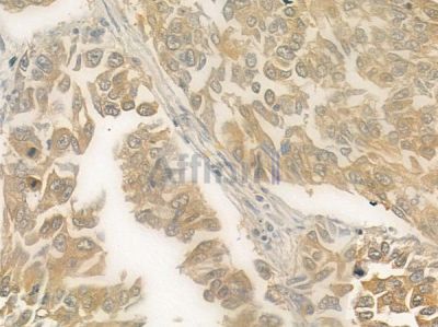 PRKX Antibody - DF4473 at 1/100 staining human normal kidney tissue by IHC-P.
