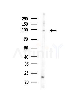 TNNI3K Antibody - Western blot analysis of lysates from Hela cells, using TNNI3K Antibody at 1/1000 dilution.