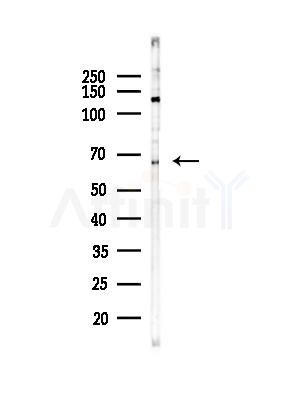 PPP2R1B Antibody - Western blot analysis of lysates from B16F10-LUC cells(heat-shock,45min treatment), using PPP2R1B Antibody at 1/1000 dilution.