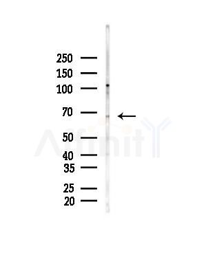 PPP2R1B Antibody - Western blot analysis of lysates from Hela cells(heat-shock,45min treatment), using PPP2R1B Antibody at 1/1000 dilution.