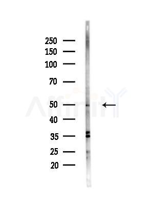PPP4R1L Antibody - Western blot analysis of lysates from HepG2 cells(heat-shock,45min treatment), using PPP4R1L Antibody at 1/1000 dilution.