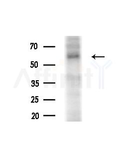 SHB Antibody - Western blot analysis of extracts from COLO205 cells(heat-shock,45min treatment), using SHB Antibody at 1/1000 dilution.