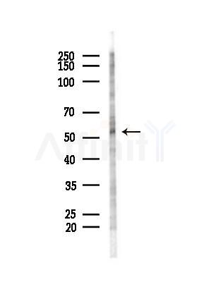 SHB Antibody - Western blot analysis of lysates from COLO205 cells(heat-shock,45min treatment), using SHB Antibody at 1/1000 dilution.