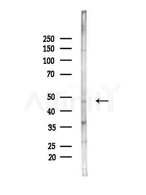 SH2D2A Antibody - Western blot analysis of lysates from HepG2 cells(heat-shock,45min treatment), using SH2D2A Antibody at 1/1000 dilution.
