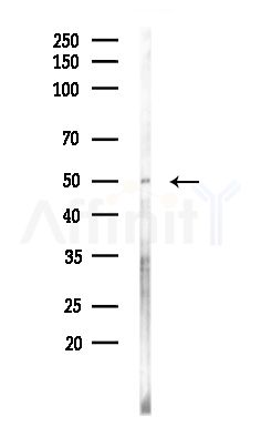 SH3GLB2 Antibody - Western blot analysis of lysates from Hela cells(heat-shock,45min treatment), using SH3GLB2 Antibody at 1/1000 dilution.