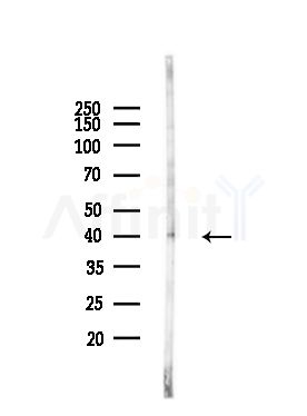 SH3GL2 Antibody - Western blot analysis of lysates from MDA-MB-231 cells(heat-shock,45min treatment), using SH3GL2 Antibody at 1/1000 dilution.