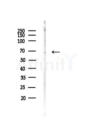 SLC6A1 Antibody - Western blot analysis of lysates from COLO205 cells, using SLC6A1 Antibody at 1/1000 dilution.