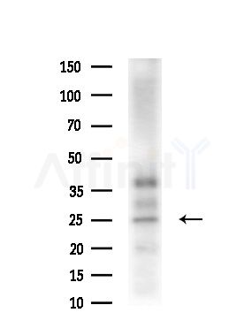 SCN2B Antibody - Western blot analysis of extracts from HUVEC cells(starvation,24h treatment), using SCN2B Antibody at 1/1000 dilution.