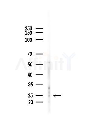 SCN2B Antibody - Western blot analysis of lysates from HUVEC cells(starvation,24h treatment), using SCN2B Antibody at 1/1000 dilution.