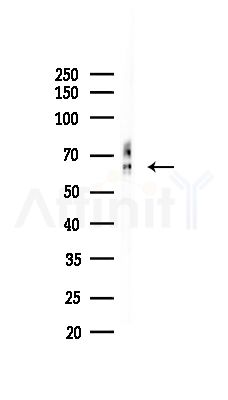 SLC9A9 Antibody - Western blot analysis of lysates from Hela cells(heat-shock,45min treatment), using SLC9A9 Antibody at 1/1000 dilution.
