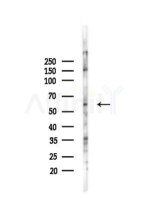 SLC28A2 Antibody - Western blot analysis of lysates from PC12 cells(LPS, 4h treatment), using SLC28A2 Antibody at 1/1000 dilution.
