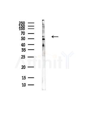 SLC24A6 Antibody - Western blot analysis of lysates from EC304 cells(heat-shock, 45min treatment), using SLC24A6 Antibody at 1/1000 dilution.