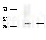 ATP1B3 Antibody - Western blot analysis of lysates from HepG2 cells(LPS 4h treatment), using ATP1B3 Antibody at 1/1000 dilution.
