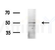SLC17A2 Antibody - Western blot analysis of extracts from HepG2 cells(LPS 4h treatment), using SLC17A2 Antibody at 1/1000 dilution.