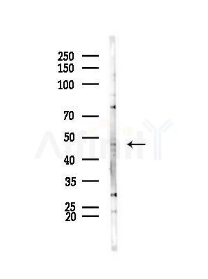 SLC17A2 Antibody - Western blot analysis of lysates from HepG2 cells(LPS,4h treatment), using SLC17A2 Antibody at 1/1000 dilution.