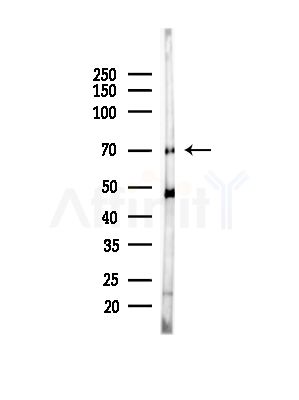 SLCO1B1 Antibody - Western blot analysis of lysates from B16F10-LUC cells(starvation,24h treatment), using SLCO1B1 Antibody at 1/1000 dilution.