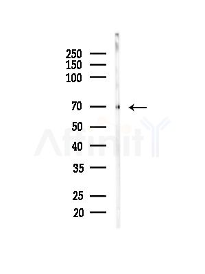 SLCO1B1 Antibody - Western blot analysis of lysates from HUVEC cells(starvation,24h treatment), using SLCO1B1 Antibody at 1/1000 dilution.