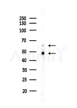 SF3B4 Antibody - Western blot analysis of lysates from Hela cells(heat-shock,45min treatment), using SF3B4 Antibody at 1/1000 dilution.