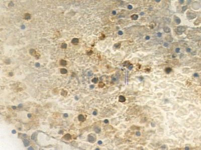 SF3B4 Antibody - DF4540 at 1/100 staining human pituitary adenoma by IHC-P.