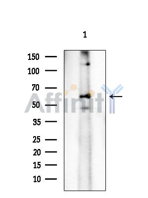 SFRS11 Antibody - Western blot analysis of extracts from COLO205 cells, using SFRS11 Antibody at 1/1000 dilution.
