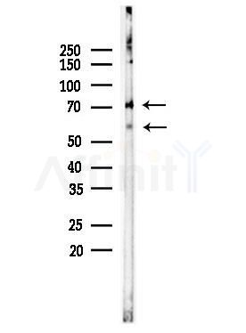SFRS11 Antibody - Western blot analysis of lysates from COLO205 cells, using SFRS11 Antibody at 1/1000 dilution.