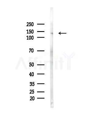 SFRS15 Antibody - Western blot analysis of lysates from Mouse brain, using SFRS15 Antibody at 1/1000 dilution.
