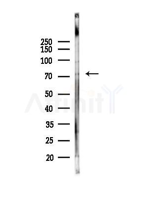 UBASH3A Antibody - Western blot analysis of lysates from B16F10-LUC cells(heat-shock,45min treatment), using UBASH3A Antibody at 1/1000 dilution.