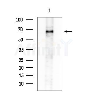 SVOP Antibody - Western blot analysis of extracts from COLO205 cells, using SVOP Antibody at 1/1000 dilution.