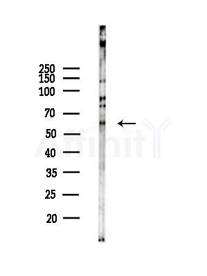 SVOP Antibody - Western blot analysis of lysates from COLO205 cells, using SVOP Antibody at 1/1000 dilution.