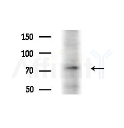 CD6 Antibody - Western blot analysis of lysates from HUVEC cells(starvation,24h treatment), using CD6 Antibody at 1/1000 dilution.