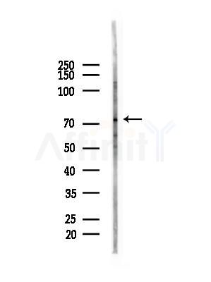 CD6 Antibody - Western blot analysis of lysates from HUVEC cells(starvation,24h treatment), using CD6 Antibody at 1/1000 dilution.