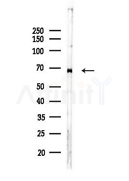 CCT5 Antibody - Western blot analysis of lysates from Hela cells(heat-shock,45min treatment), using CCT5 Antibody at 1/1000 dilution.