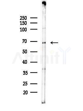 CCT5 Antibody - Western blot analysis of lysates from RAW264.