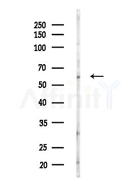 CCT7 Antibody - Western blot analysis of lysates from MDA-MB-231 cells(heat-shock,45min treatment), using CCT7 Antibody at 1/1000 dilution.