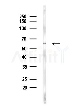 CCT7 Antibody - Western blot analysis of lysates from LOV0(heat-shock,45min treatment), using CCT7 Antibody at 1/1000 dilution.