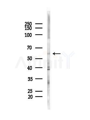 CCT6A Antibody - Western blot analysis of lysates from COLO205 cells(heat-shock,45min treatment), using CCT6A Antibody at 1/1000 dilution.