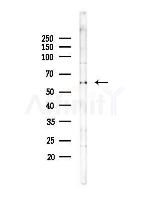 CCT6A Antibody - Western blot analysis of lysates from B16F10-LUC cells(heat-shock,45min treatment), using CCT6A Antibody at 1/1000 dilution.