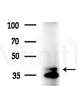 GTF3A Antibody - Western blot analysis of extracts from B16F10-LUC cells(starvation,24h treatment), using GTF3A Antibody at 1/1000 dilution.