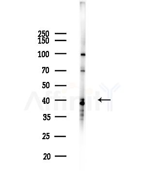 GTF3A Antibody - Western blot analysis of lysates from B16F10-LUC cells(starvation,24h treatment), using GTF3A Antibody at 1/1000 dilution.