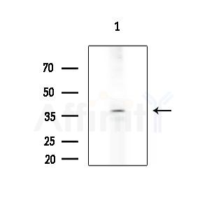 MTERF Antibody - Western blot analysis of extracts from COLO205 cells, using MTERF Antibody at 1/1000 dilution.