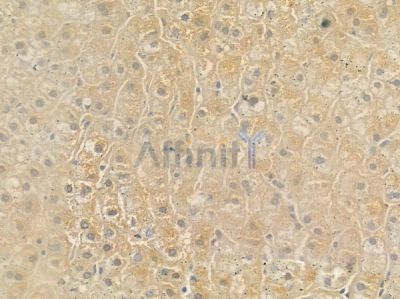 MTERF Antibody - DF4576 at 1/100 staining human normal liver tissue by IHC-P.