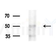 EIF2B3 Antibody - Western blot analysis of extracts from HepG2 cells(LPS 4h treatment), using EIF2B3 Antibody at 1/1000 dilution.