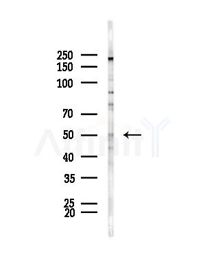 EIF2B3 Antibody - Western blot analysis of lysates from HepG2 cells(LPS,4h treatment), using EIF2B3 Antibody at 1/1000 dilution.