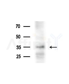 TMBIM1 Antibody - Western blot analysis of extracts from HUVEC cells(starvation,24h treatment), using TMBIM1 Antibody at 1/1000 dilution.