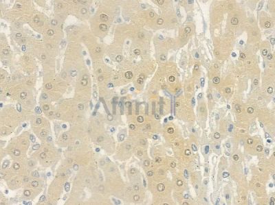 TSEN54 Antibody - DF4581 at 1/100 staining human normal liver tissue by IHC-P.