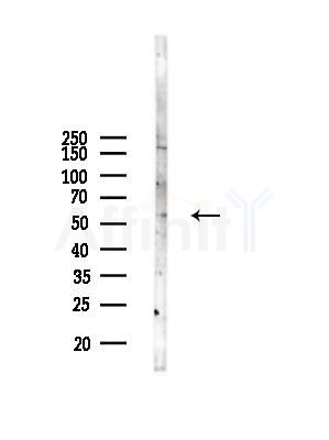 TSEN54 Antibody - Western blot analysis of lysates from Mouse 丸, using TSEN54 Antibody at 1/1000 dilution.